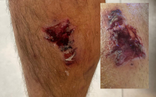  يافا: هذا ما تسببه قنابل الشرطة الصوتية للمواطنين 